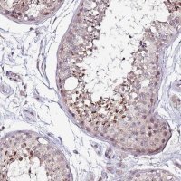 Anti-DUSP28 antibody produced in rabbit 