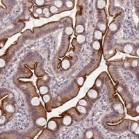 Anti-DUSP28 antibody produced in rabbit 