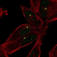 Anti-E2F1 antibody produced in rabbit 