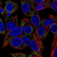 Anti-EARS2 antibody produced in rabbit