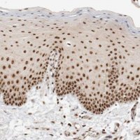 Anti-EBNA1BP2 antibody produced in rabbit 
