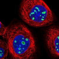 Anti-EBNA1BP2 antibody produced in rabbit 