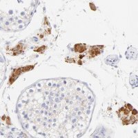 Anti-EBP antibody produced in rabbit 