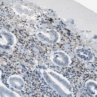 Anti-ECD antibody produced in rabbit 