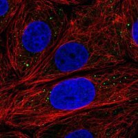 Anti-EDC3 antibody produced in rabbit 