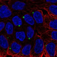 Anti-EDEM1 antibody produced in rabbit 