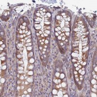 Anti-EEA1 antibody produced in rabbit HPA038159-100UL