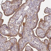 Anti-EEF1AKMT1 antibody produced in rabbit