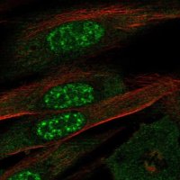 Anti-EFCAB13 antibody produced in rabbit 