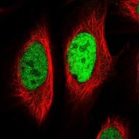 Anti-EGR1 antibody produced in rabbit 