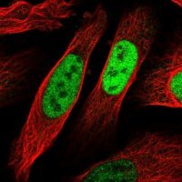 Anti-EGR1 antibody produced in rabbit 