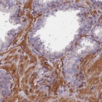 Anti-EHBP1L1 antibody produced in rabbit 