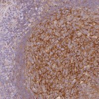 Anti-EHD3 antibody produced in rabbit 