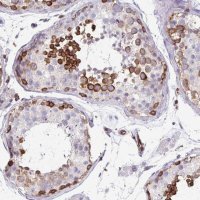 Anti-EHD4 antibody produced in rabbit 