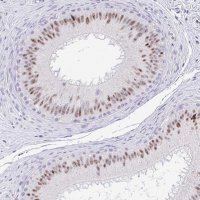 Anti-EID3 antibody produced in rabbit 
