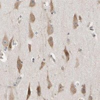 Anti-EIF1AX antibody produced in rabbit 