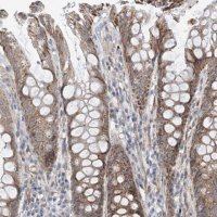 Anti-EIF2A antibody produced in rabbit 