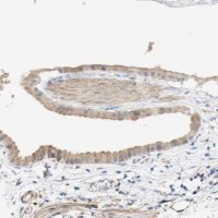 Anti-EIF2AK4 antibody produced in rabbit HPA011811-100UL