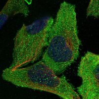 Anti-EIF2B3 antibody produced in rabbit