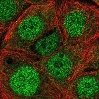 Anti-EIF3B antibody produced in rabbit 