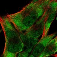 Anti-EIF3D antibody produced in rabbit