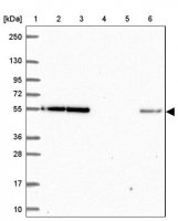 Anti-EIF3D antibody produced in rabbit HPA063330-100UL