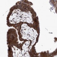 Anti-EIF3M antibody produced in rabbit HPA031063-100UL