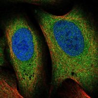 Anti-EIF3M antibody produced in rabbit HPA031063-100UL