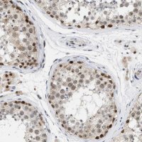 Anti-ELAC2 antibody produced in rabbit 