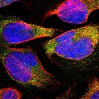 Anti-ELP2 antibody produced in rabbit 