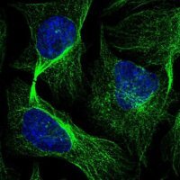 Anti-EMC1 antibody produced in rabbit 