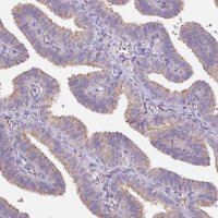 Anti-EMC6 antibody produced in rabbit HPA062681-100UL