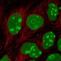 Anti-EMG1 antibody produced in rabbit HPA039304-100UL