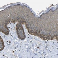 Anti-EML2 antibody produced in rabbit HPA012757-100UL