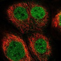 Anti-EOGT antibody produced in rabbit 