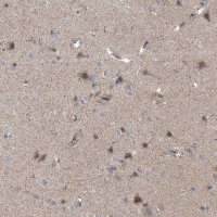 Anti-EOMES antibody produced in rabbit