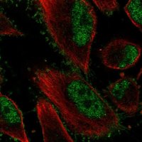 Anti-EPHB2 antibody produced in rabbit HPA071200-100UL