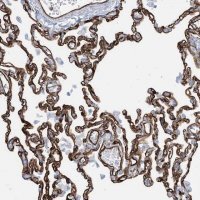 Anti-EPS8L3 antibody produced in rabbit