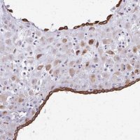 Anti-EPYC antibody produced in rabbit 