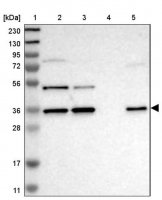 Anti-ERGIC3 antibody produced in rabbit HPA015968-100UL