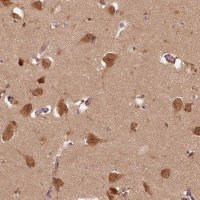 Anti-ERI3 antibody produced in rabbit HPA029895-100UL