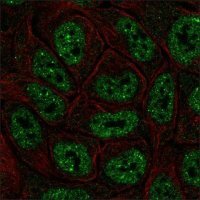 Anti-ESRP1 antibody produced in rabbit HPA023720-100UL
