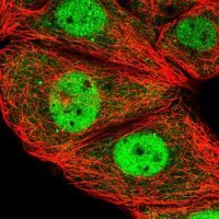 Anti-ESRP2 antibody produced in rabbit 
