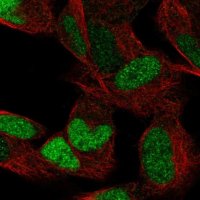 Anti-ESRRG antibody produced in rabbit