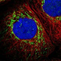 Anti-ETFB antibody produced in rabbit 