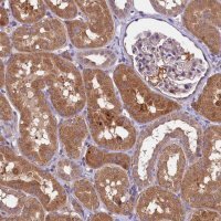 Anti-ETFBKMT antibody produced in rabbit