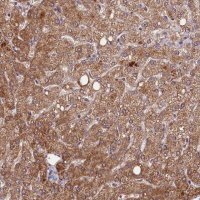 Anti-ETFBKMT antibody produced in rabbit