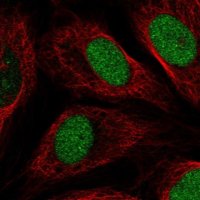 Anti-ETNPPL antibody produced in rabbit 