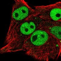 Anti-ETV5 antibody produced in rabbit