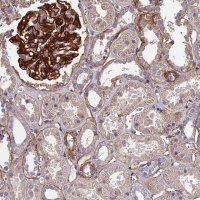 Anti-EVA1B antibody produced in rabbit